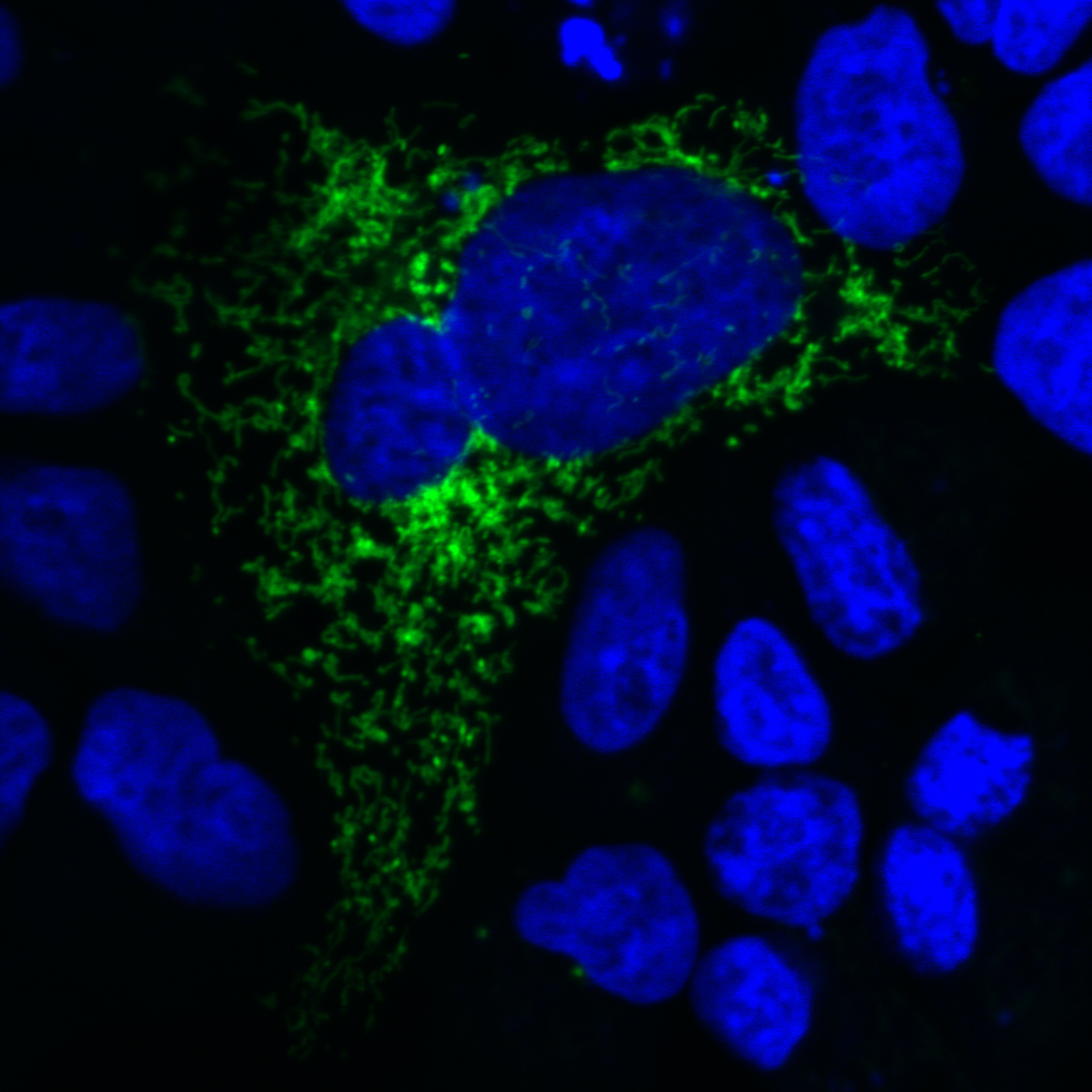 Green fluorescent mitochondria in a HEK cell